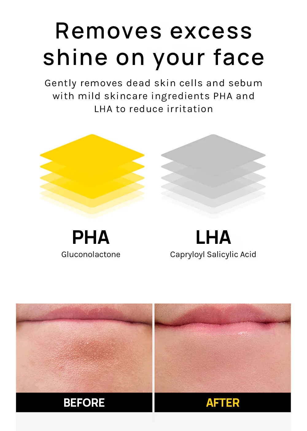 MEDIHEAL Vitamin C Brightening Serum - Mrs Treak