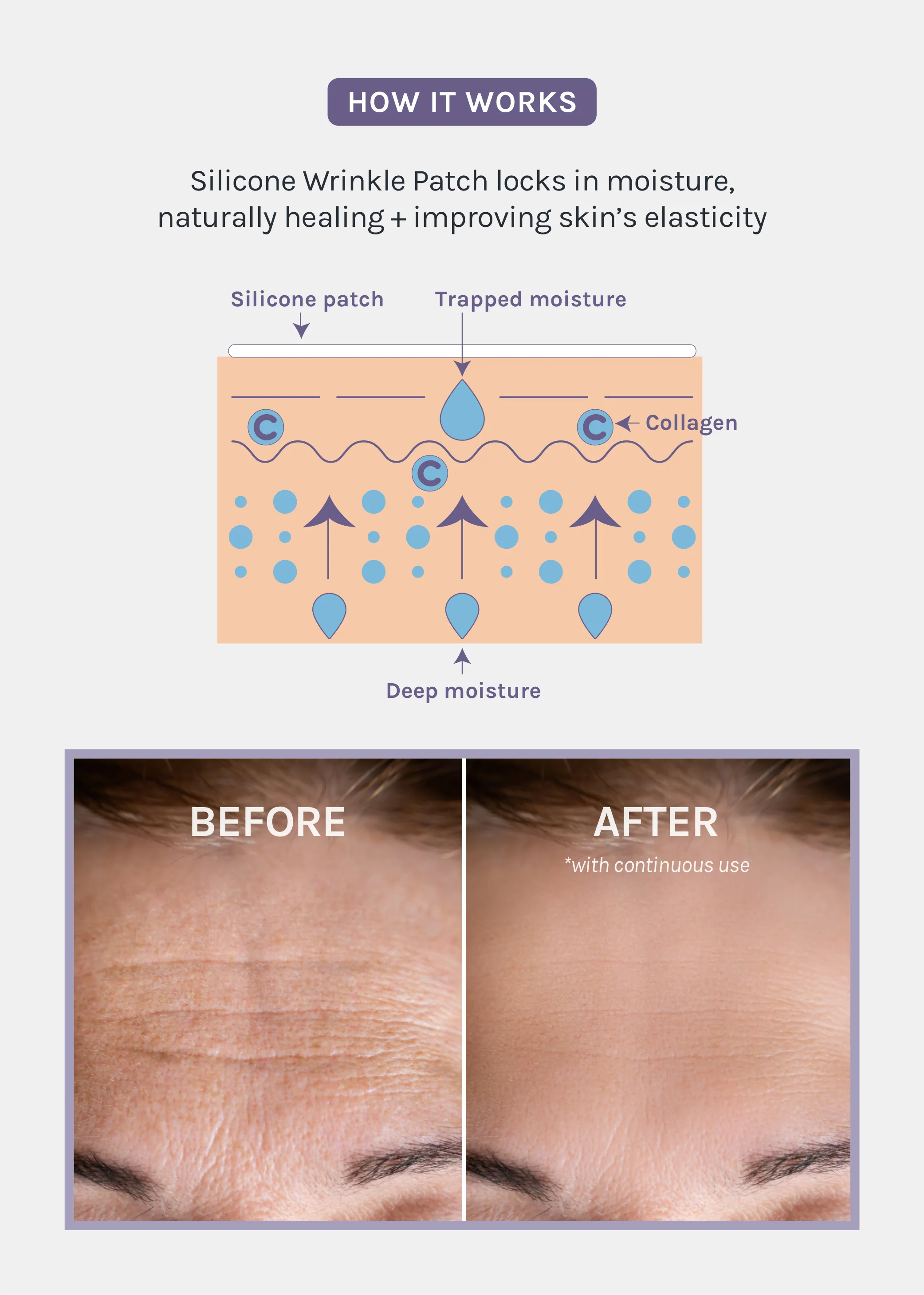 AOA Skin Wrinkle Smoothing Patch �C Chest - Mrs Treak