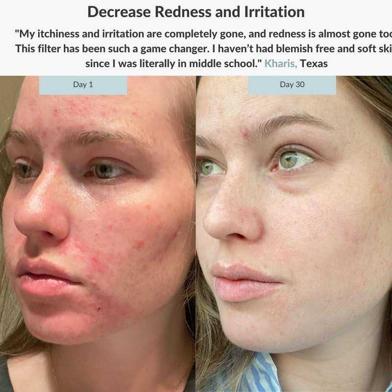 Filterbaby Advanced Water Filter With PRODermis - MT - Mrs Treak